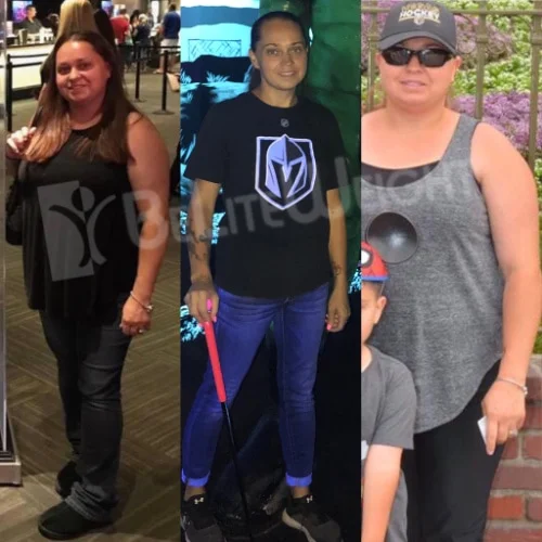 Weight Loss Surgery Before and After Lyndsay E - 21 Month Update*